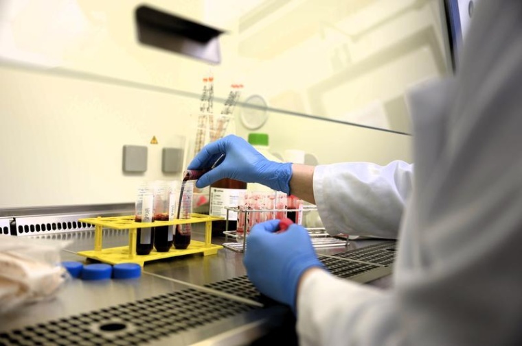 Mithilfe einer von Prof. Petra Bacher und Prof. Alexander Scheffold...