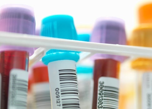 Foto: Wiley Getty Images