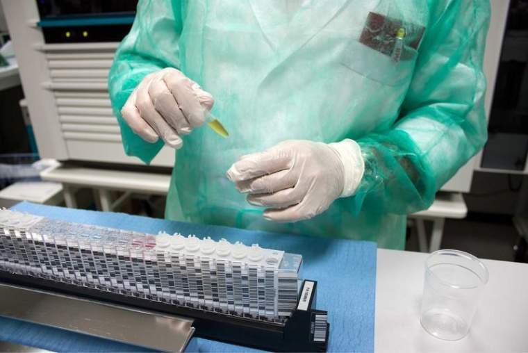 Für die Studie analysierten die Forscher*innen klinische Werte,...