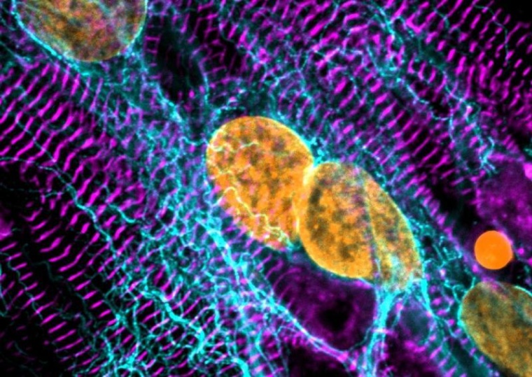Induzierte pluripotente Stammzell-Kardiomyozyten, gefärbt für das...