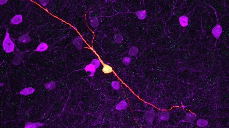 Abbildung einer reprogrammierten Gliazelle. Foto: Universitätsmedizin Mainz /...