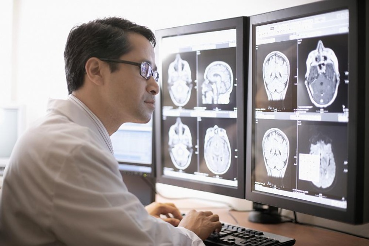 Der Zeitpunkt eines Schlaganfalls wird derzeit meist anhand von CT-Aufnahmen...