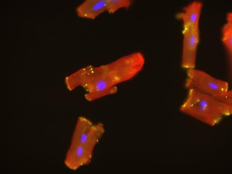 Mechanische Herzunterstützung fördert Regeneration von Herzmuskelzellen