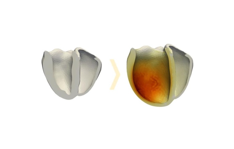 Ein mit der Software 4C simuliertes Herz (in aufgeschnittener Darstellung):...