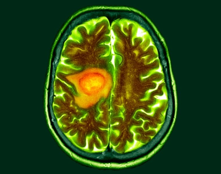 Foto: Wiley Getty Images