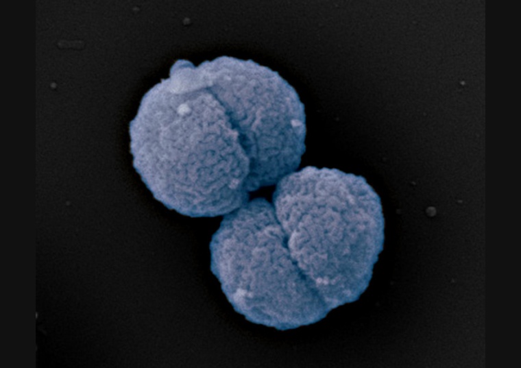 Neisseria gonorrhoeae (Gonokokken), der Erreger der Gonorrhö (Tripper)....