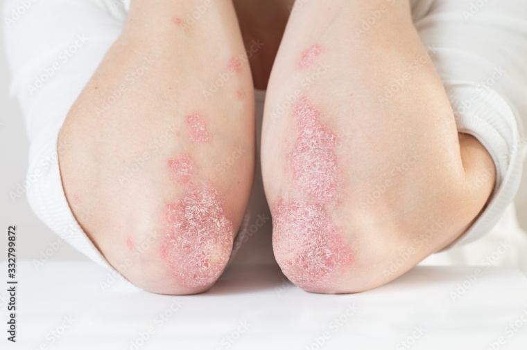 Foto: Wiley Adobe Stock