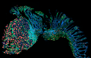 Treiber der Krebsentwicklung: der Entzündungsbotenstoff Onkostatin M ist...