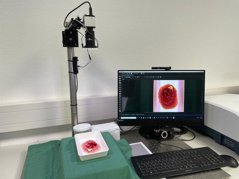 Zur Entwicklung des KI-gestützten Wundassistenzsystems werden umfangreiche...