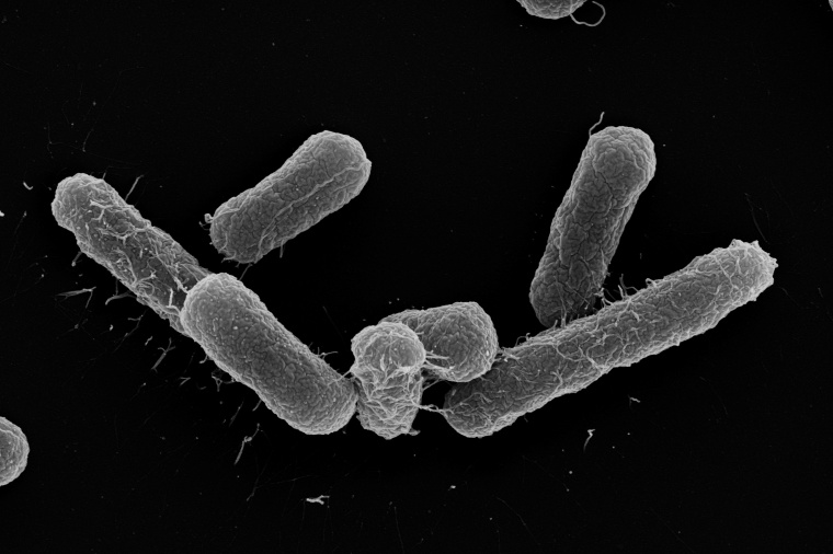 Elektronenmikroskopische Aufnahme des E. coli-Stamms, der multiresistente E....