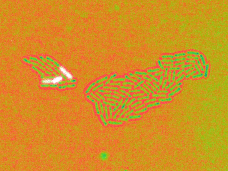 Zellen von Pseudomonas aeruginosa in Falschfarben dargestellt. Weiße Zellen...