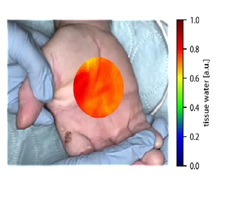 Foto: Seidlitz, DKFZ