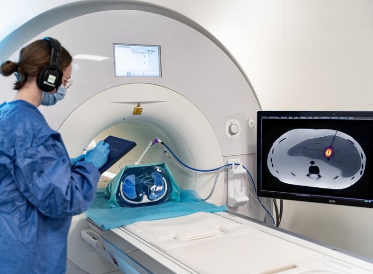 Symbolbild für eine Tumorbehandlung im MRT: Eine Radiologin überwacht die...