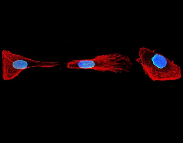 Zellen verändern ihre Gestalt, um sich durch komplexe Strukturen zu bewegen....