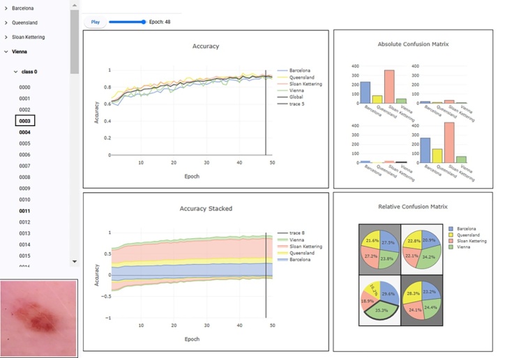 KI-fähige Daten für die Medizin – Interaktives Dashboard und...