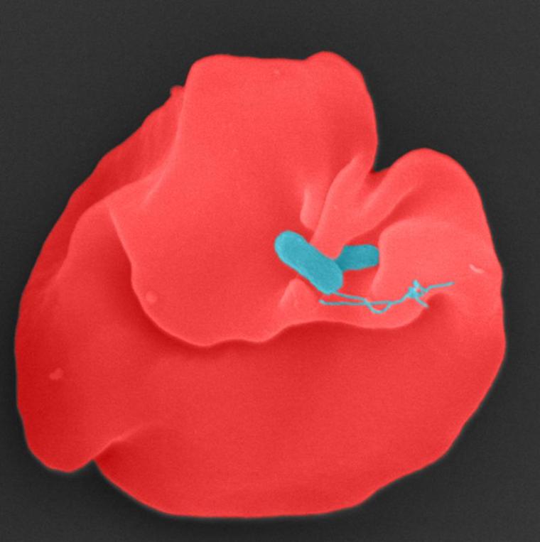 Bartonella bacilliformis (blau) infiziert einen menschlichen Erythrozyten.