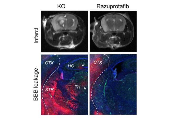 Therapeutische Aktivierung des Tie2 Signalwegs mit dem Tie2 Aktivator AKB3997...