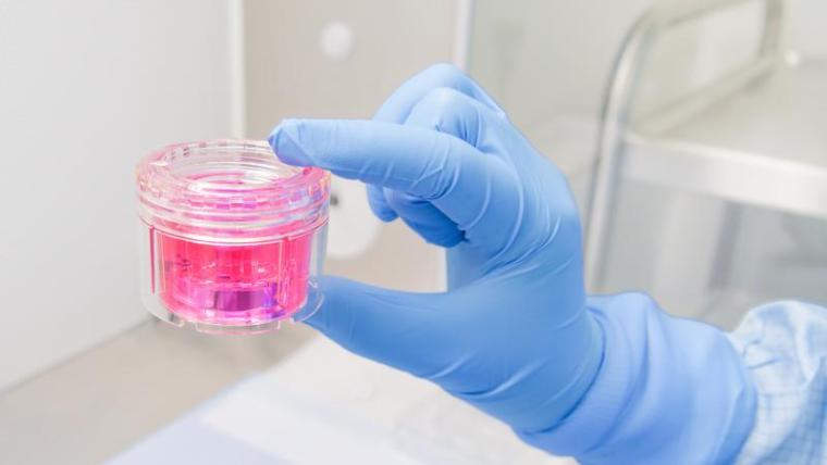 Gewebetransplantat in Nährlösung aus der Gewebebank Hannover