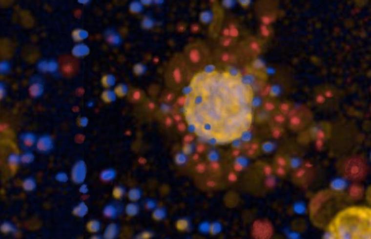 Gentechnisch veränderte Immunzellen (CAR-T-Zellen, blau) greifen...