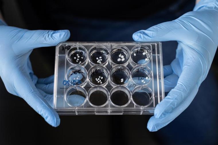 30 und 60 Tage alte Hirnorganoide in der Petrischale. .