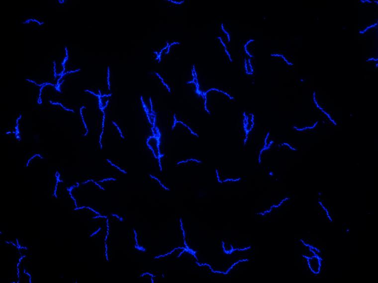 Der blau fluoreszierende Erreger Borrelia recurrentis in Kultur