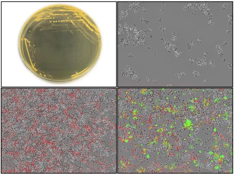 S. cerevisiae bremst den Krankheitserreger C. albicans aus. Oben: Kulturen von...