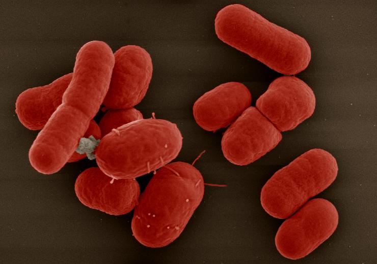 Acinetobacter baumannii. Rasterelektronen¬mikroskopie